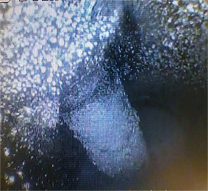 黑不溜秋的還有粉末狀，好惡心~  