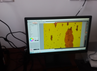 油液監(jiān)測(cè)